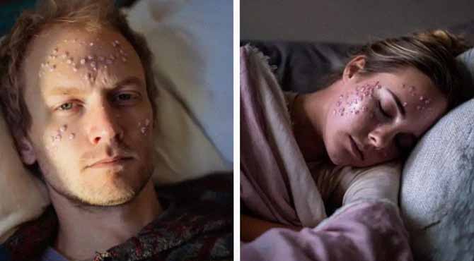 My Husband Caught Chickenpox ‘On a Work Trip’ – My Stepsister’s Spots Exposed the Truth